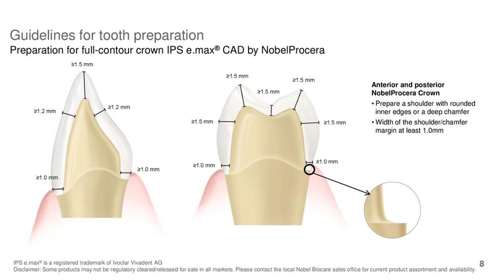 guidelines-for-tooth-preparation